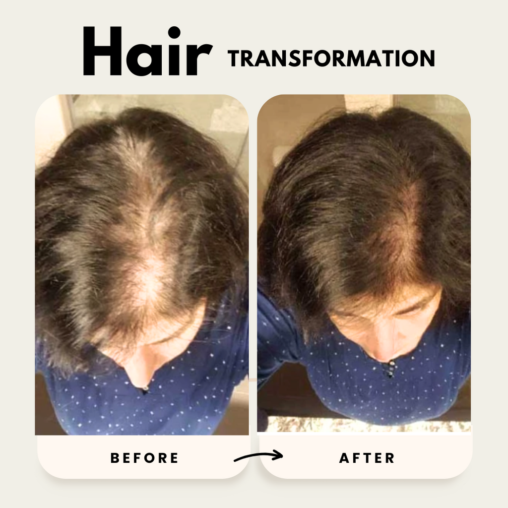 Hair Growth Shampoo and Conditioner Duo