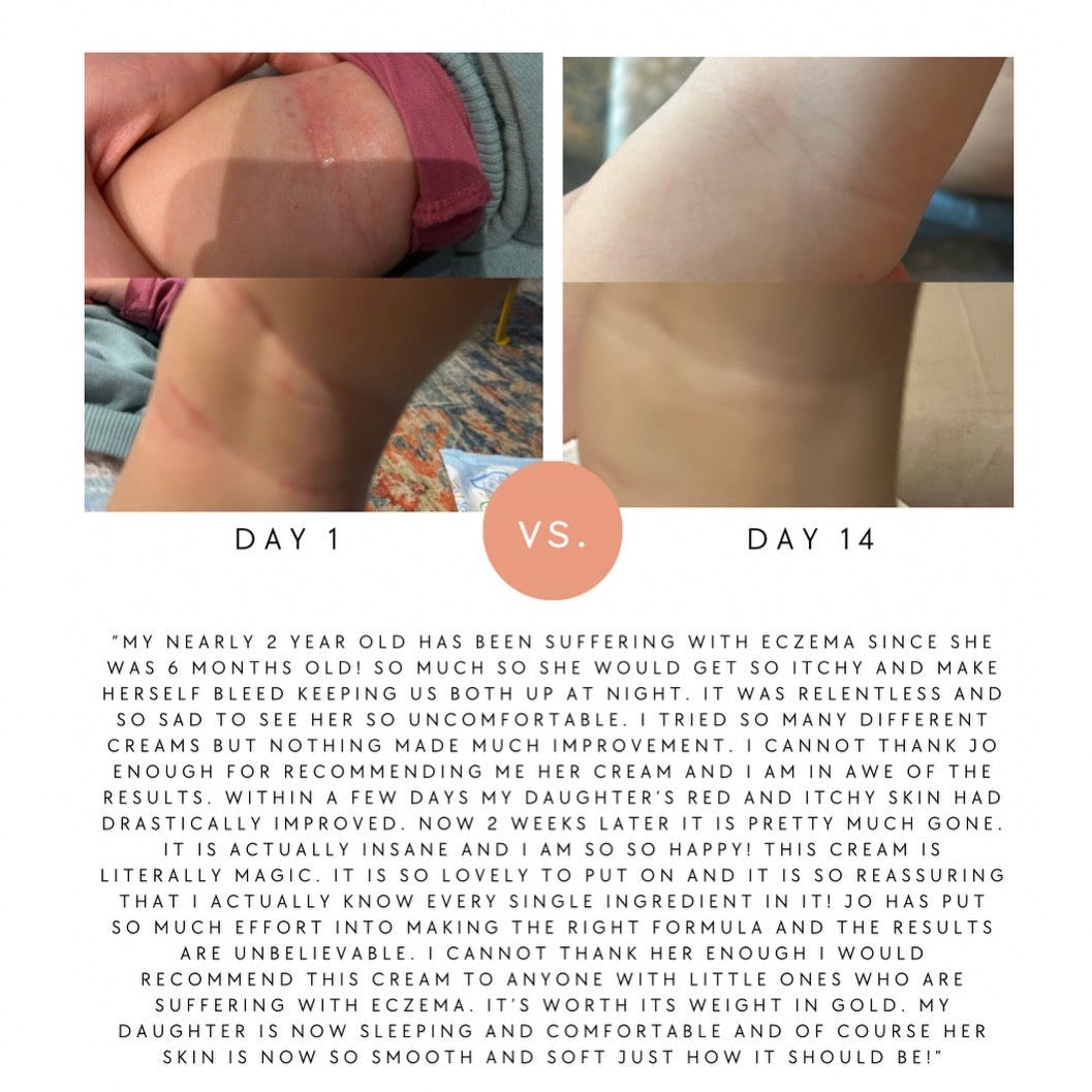 Hydrate & Calm Balm (was Baby & Child)