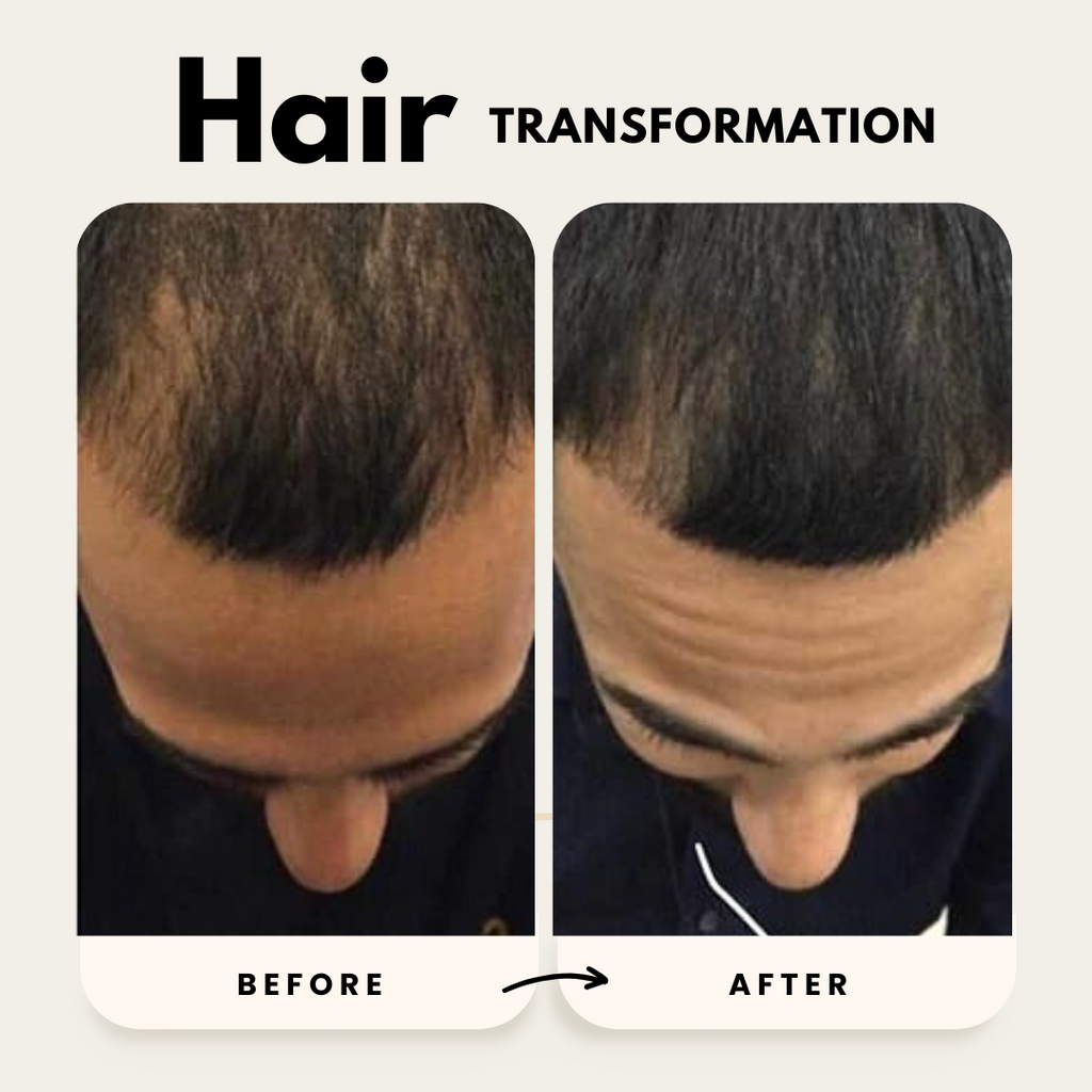 Hair Growth Shampoo and Conditioner Duo