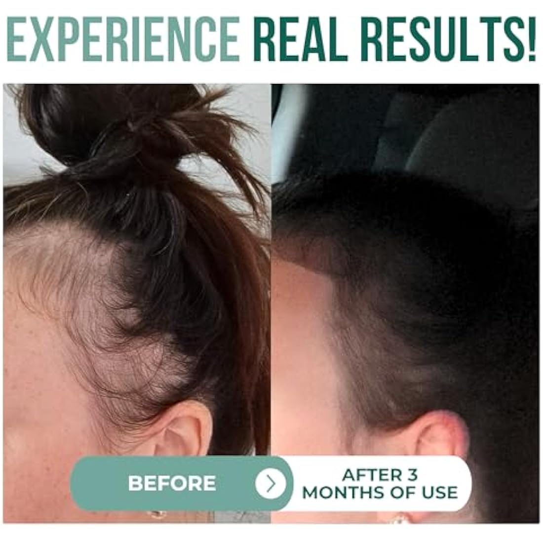 Pure Organic Batana Oil for Hair Growth and Scalp Care