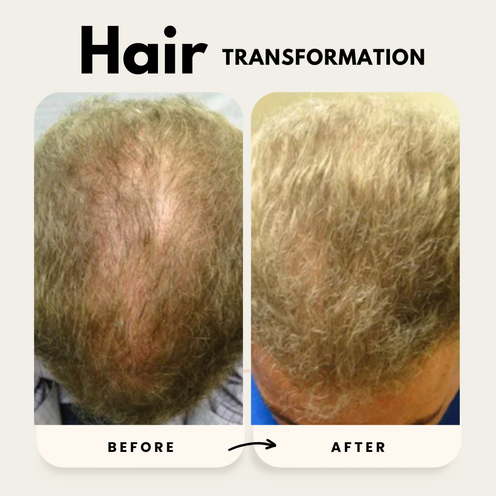 Hair Growth Shampoo and Conditioner Duo