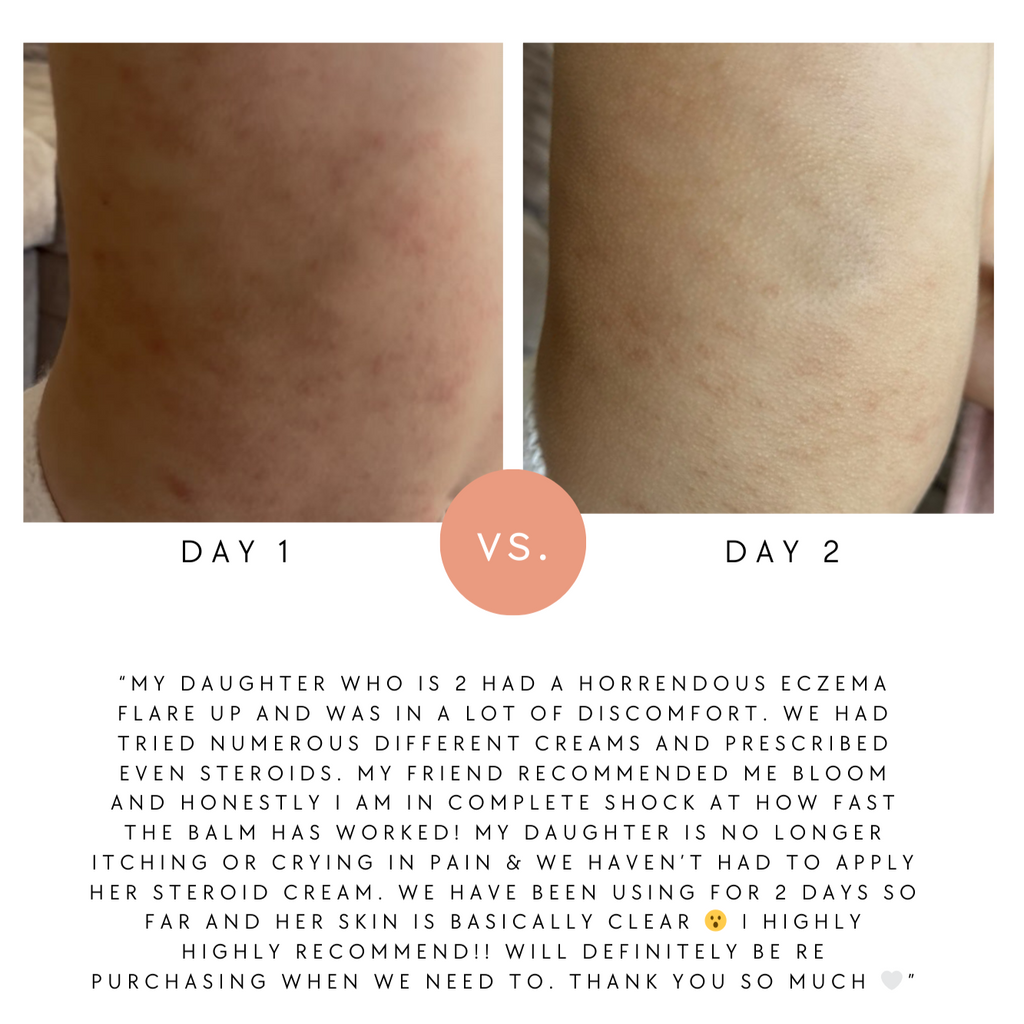 Hydrate & Calm Balm (was Baby & Child)