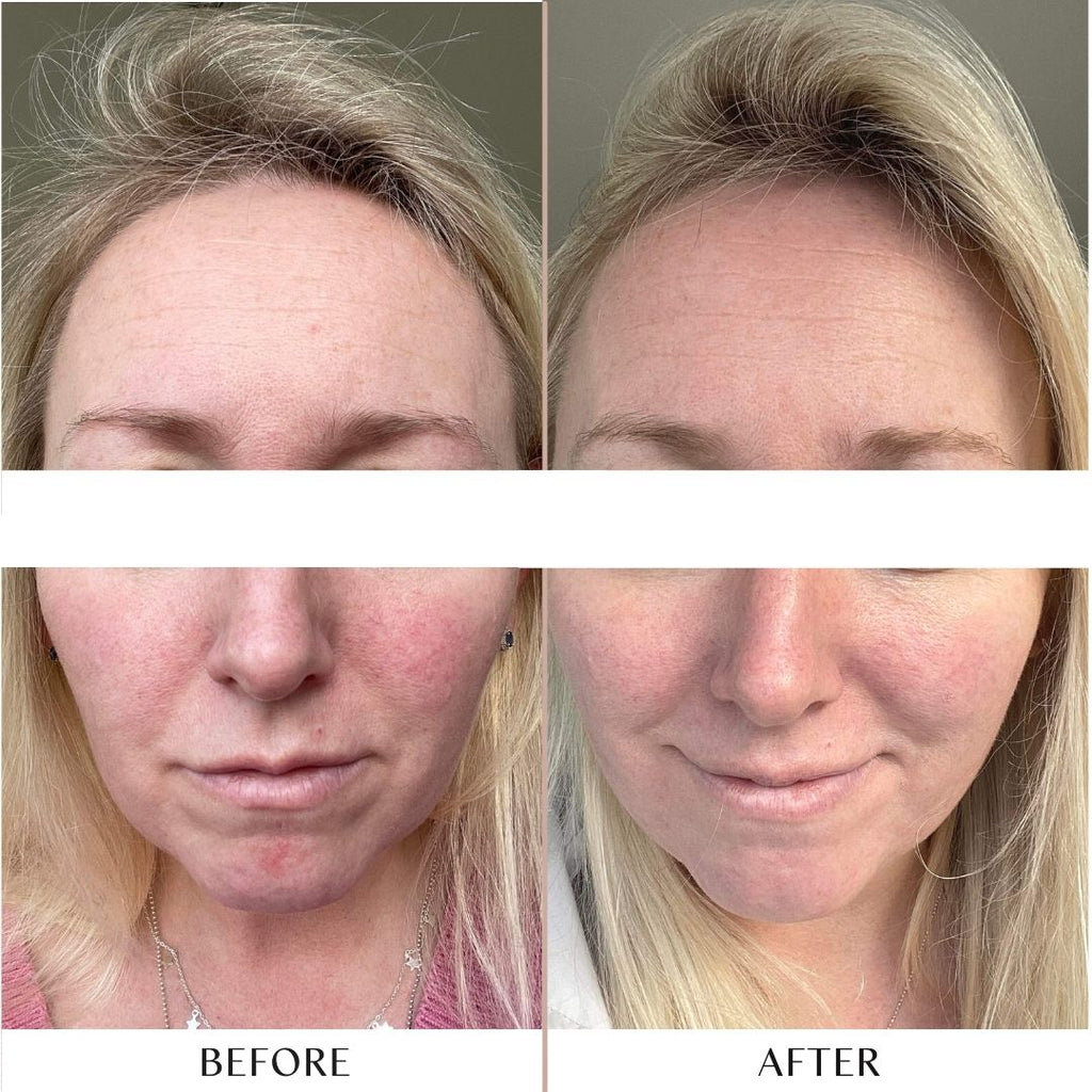 Replenish Hydrating Serum