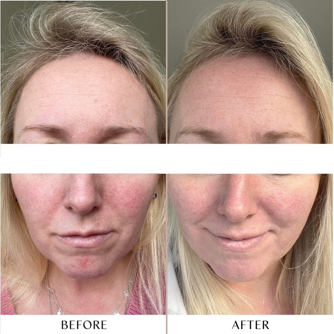 Replenish Hydrating Serum