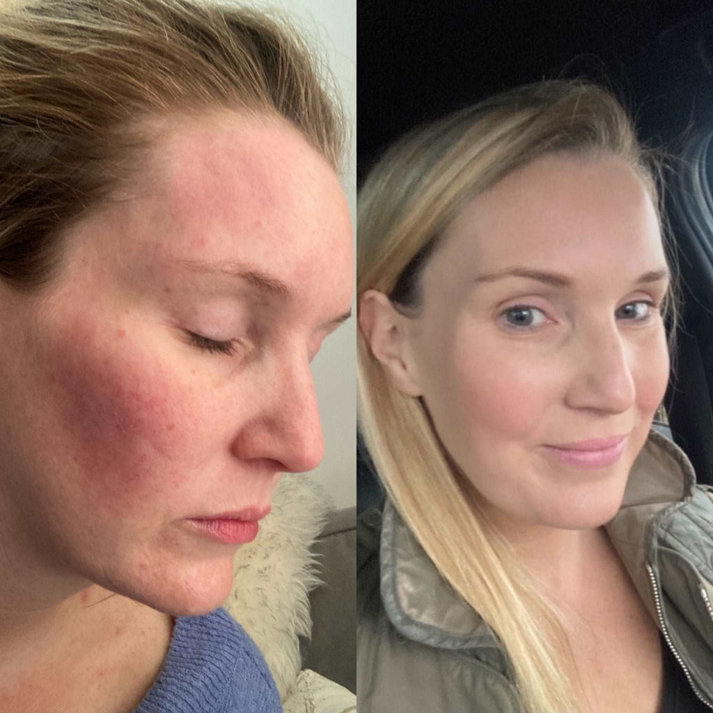 Coconut and Rosehip Calming Cream 100ml