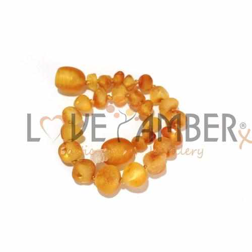 Child Bee's Knees Raw Honey Baltic Amber Anklet Bracelet