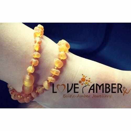 Child Bee's Knees Raw Honey Baltic Amber Anklet Bracelet