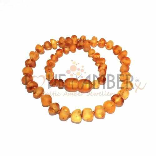 Child Bees Knees Raw Honey Baltic Amber Necklace
