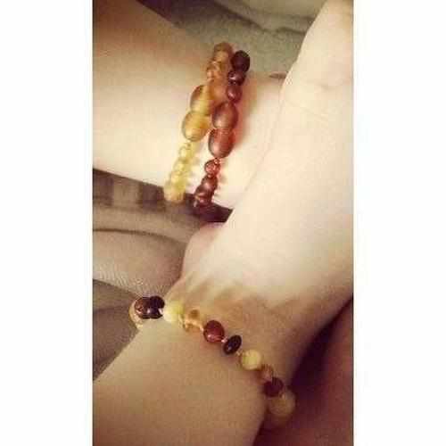 Brandy Snap Cognac Baltic Amber Anklet Bracelet for Children