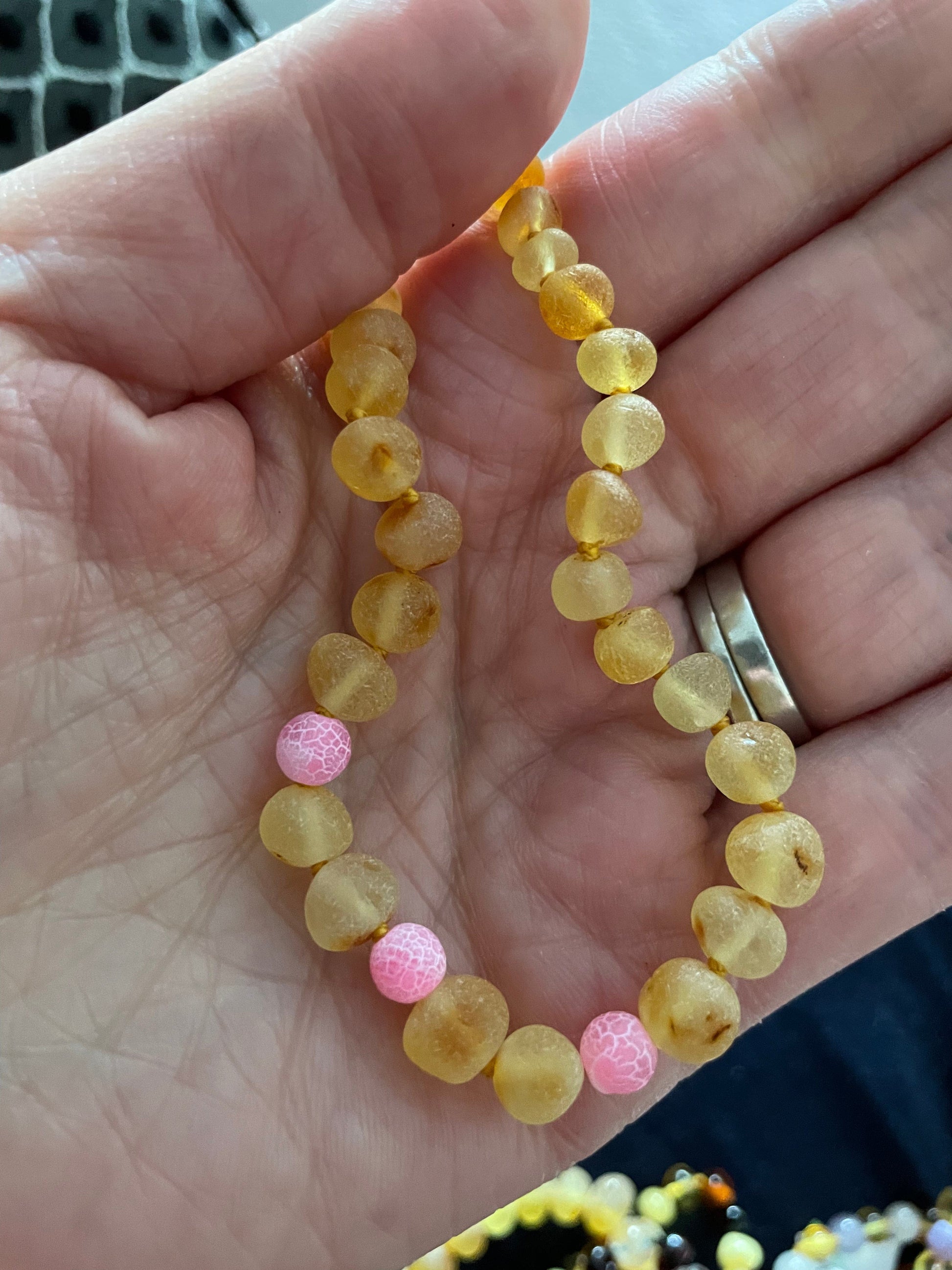 Raw Honey Pink Dragon Agate Baltic Amber Anklet Bracelet