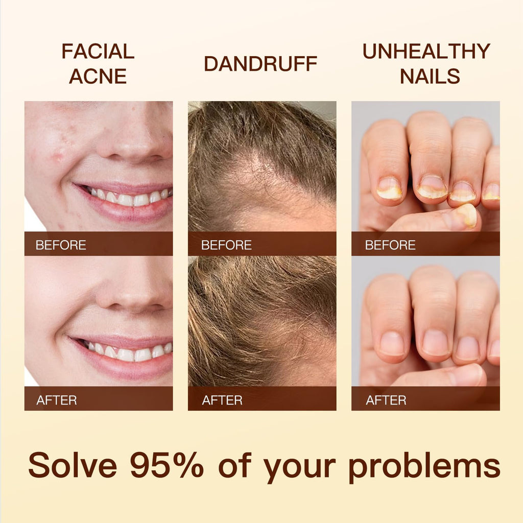 Batana Oil Blend for Hair Growth and Better Sleep, 30ml