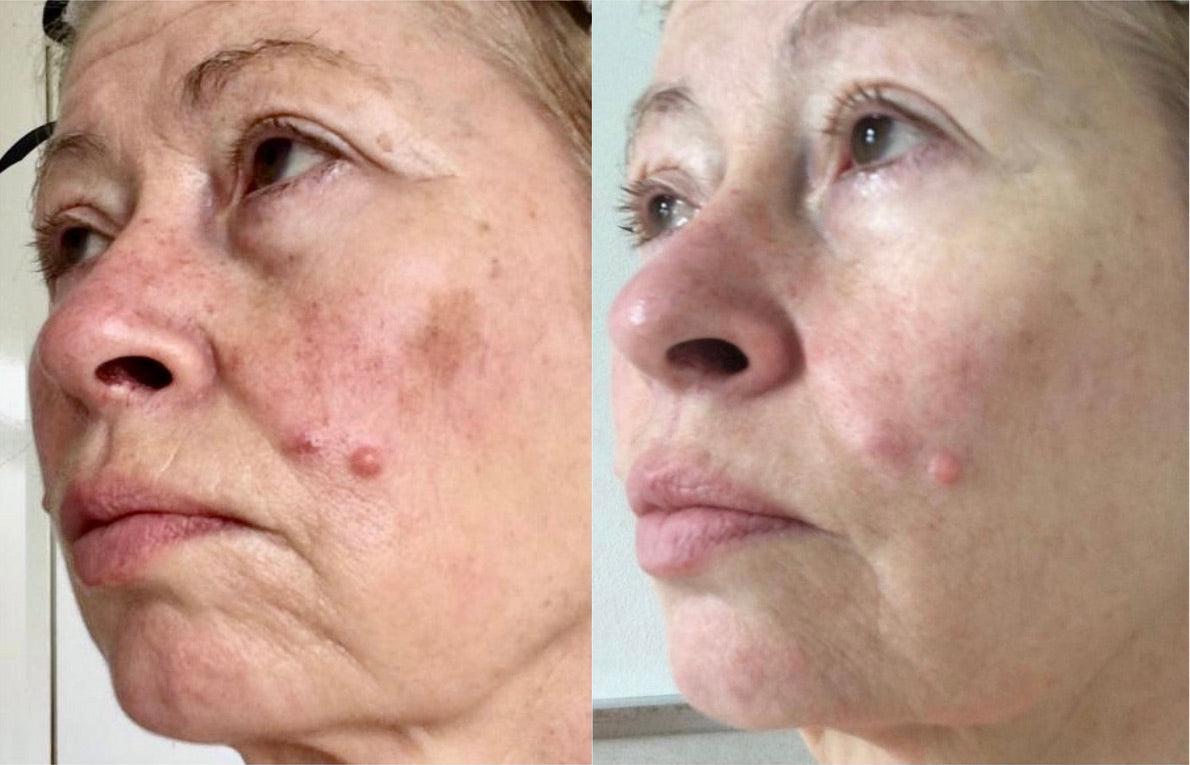 Organic Argan Wrinkle Rehab Serum 30ml